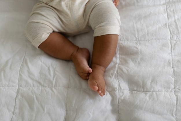 Understanding Neonatal Jaundice (Hyperbilirubinemia)